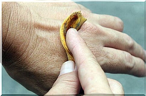 remedy with banana peels for warts