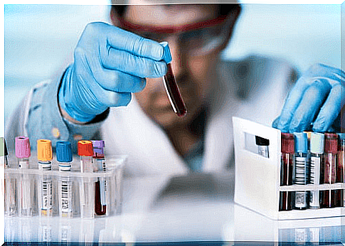 Man does lab tests on coronavirus-HIV link