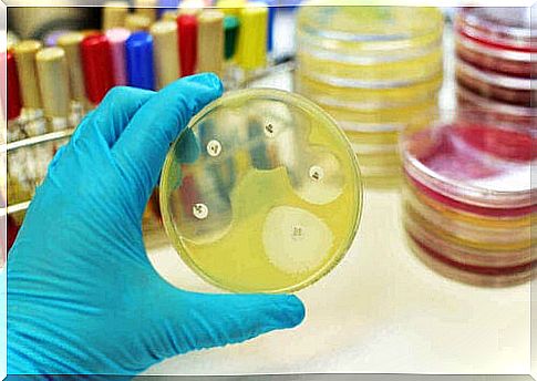 The laboratory study of Candida auris