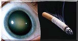 Smoking contributes to the development of cataracts.